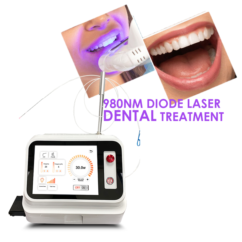 Teeth Whitening With Laser - 2024年ホットセール デンタルソフトティシューレーザーマシン 980nm ダイオードデンタルレーザー治療器 歯のホワイトニングデバイス