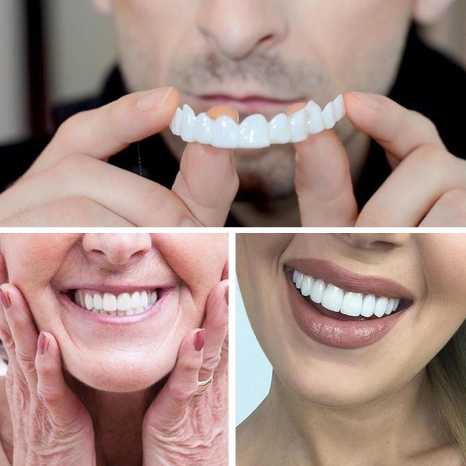 Teeth Whitening In Office - スナップオン式義歯キット 一時的な歯のホワイトニング 交換用一時的な歯 男女兼用