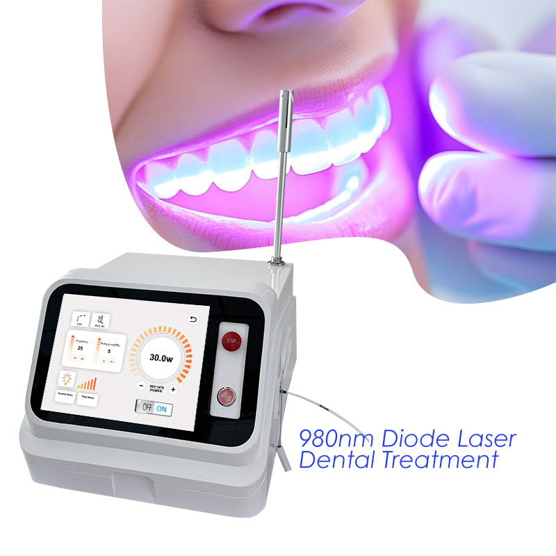 2024年ホットセール デンタルソフトティシューレーザーマシ - Teeth Whitening With Laser のレビューと価格