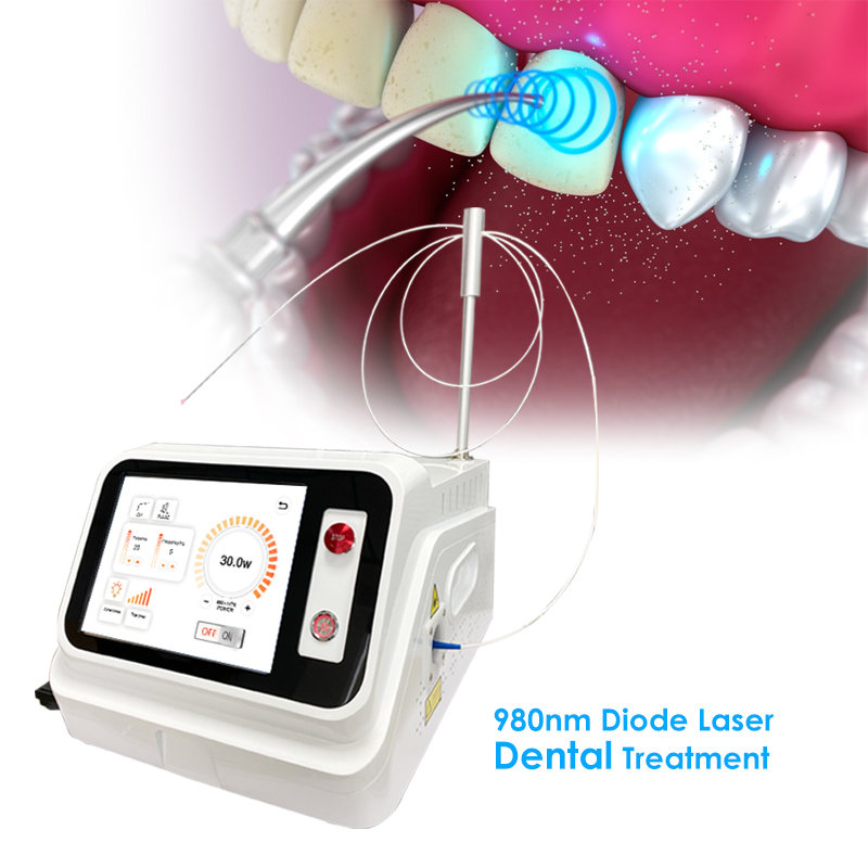 2024年ホットセール デンタルソフトティシューレーザーマシ - Teeth Whitening With Laser のレビューと価格