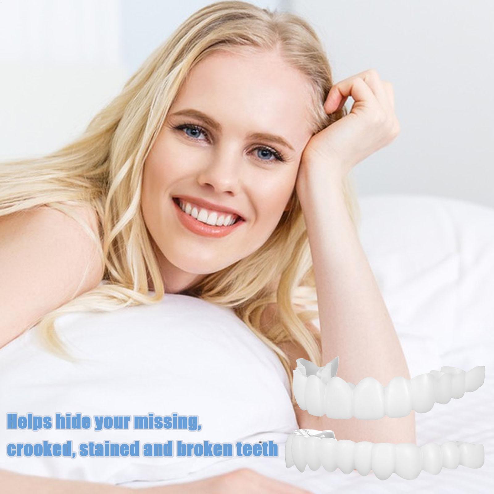 スナップオン式義歯キット 一時的な歯のホワイトニング 交換用 - Teeth Whitening In Office のレビューと価格