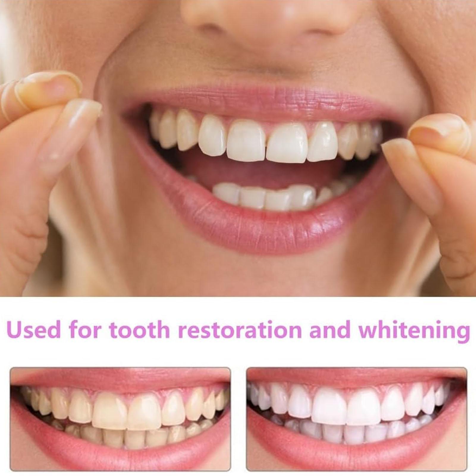 スナップオン式義歯キット 一時的な歯のホワイトニング 交換用 - Teeth Whitening In Office のレビューと価格