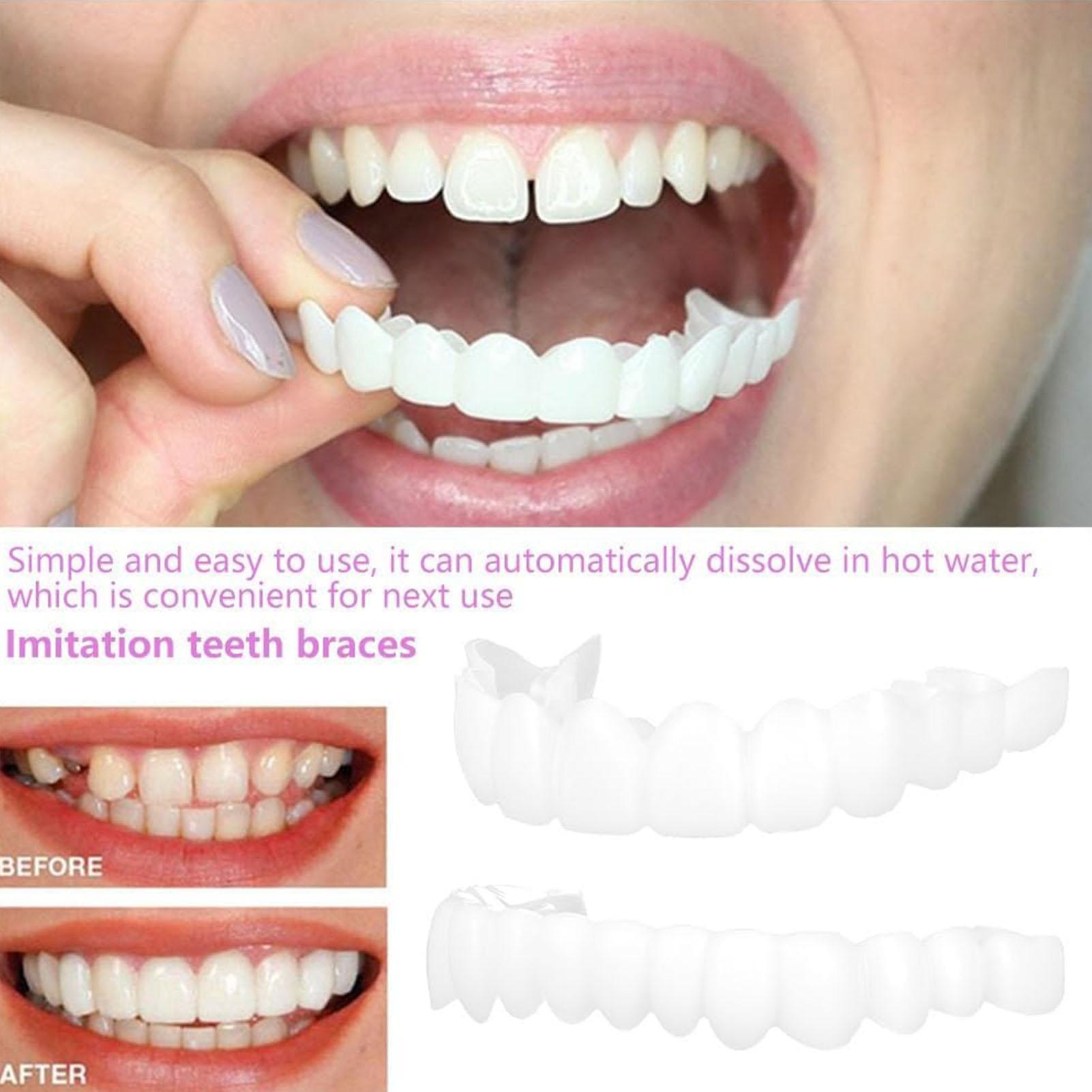 スナップオン式義歯キット 一時的な歯のホワイトニング 交換用 - Teeth Whitening In Office のレビューと価格