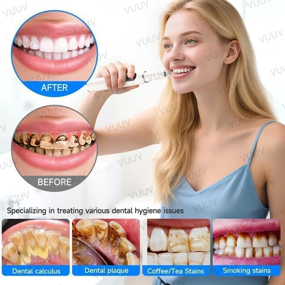 VUUV 超音波歯クリーナー女性歯石除去剤ステイン消しゴムマ - Teeth Whitening Uv のレビューと価格