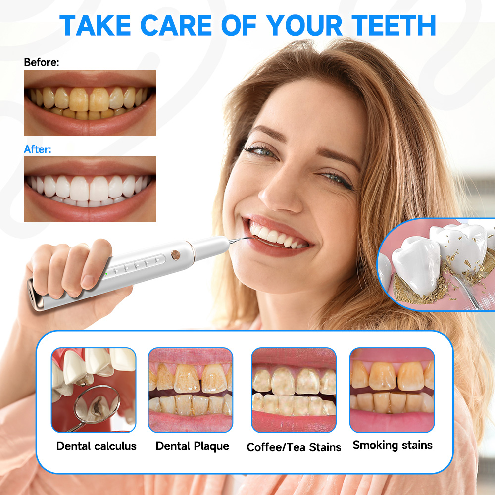 CURVY MOON T4 ポータブル超音波電動歯ブラシプロ - Teeth Whitening Uv のレビューと価格