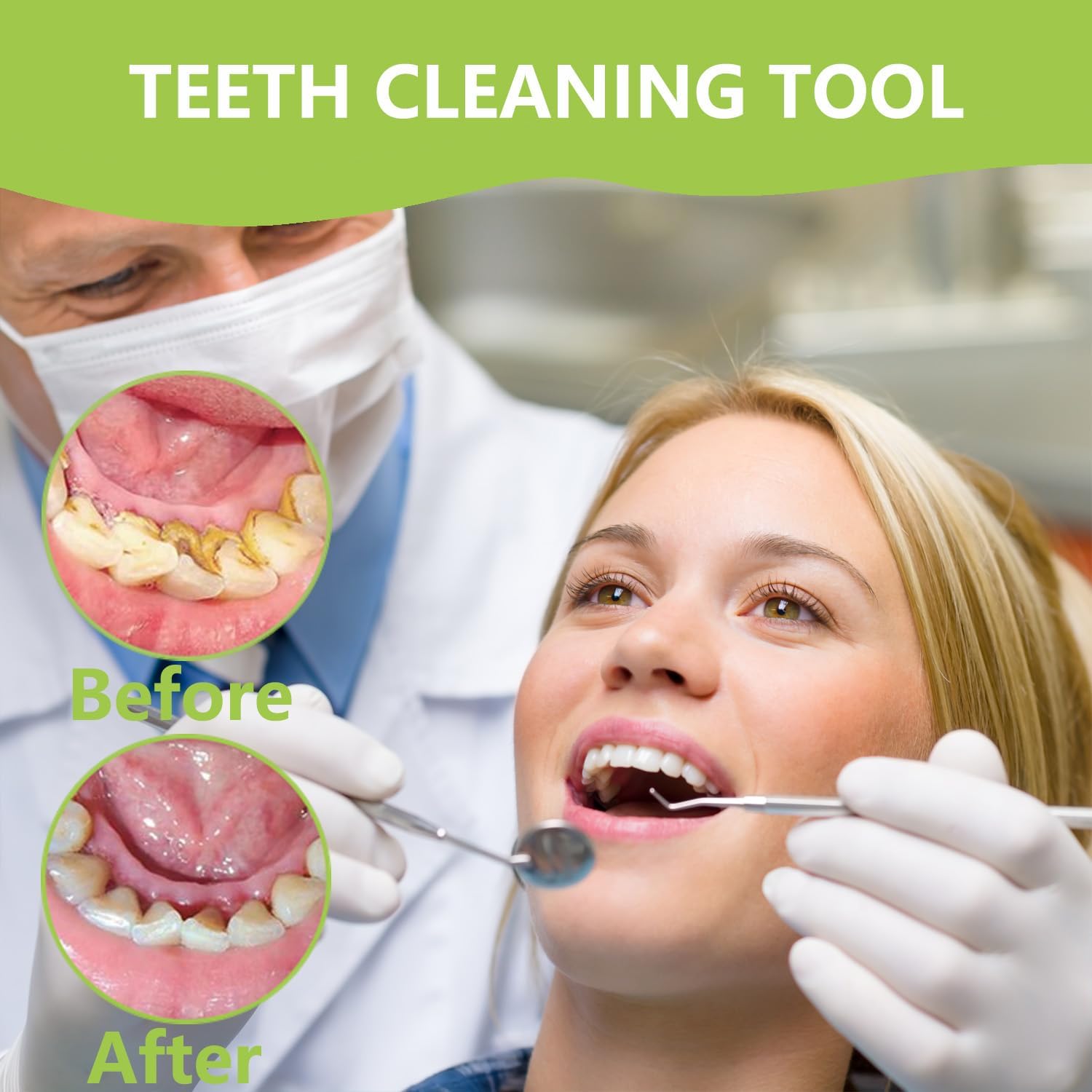 プロの歯のクリーニング口腔ケア衛生キット、ステンレス鋼のデン - Teeth Whitening Machine Professional のレビューと価格