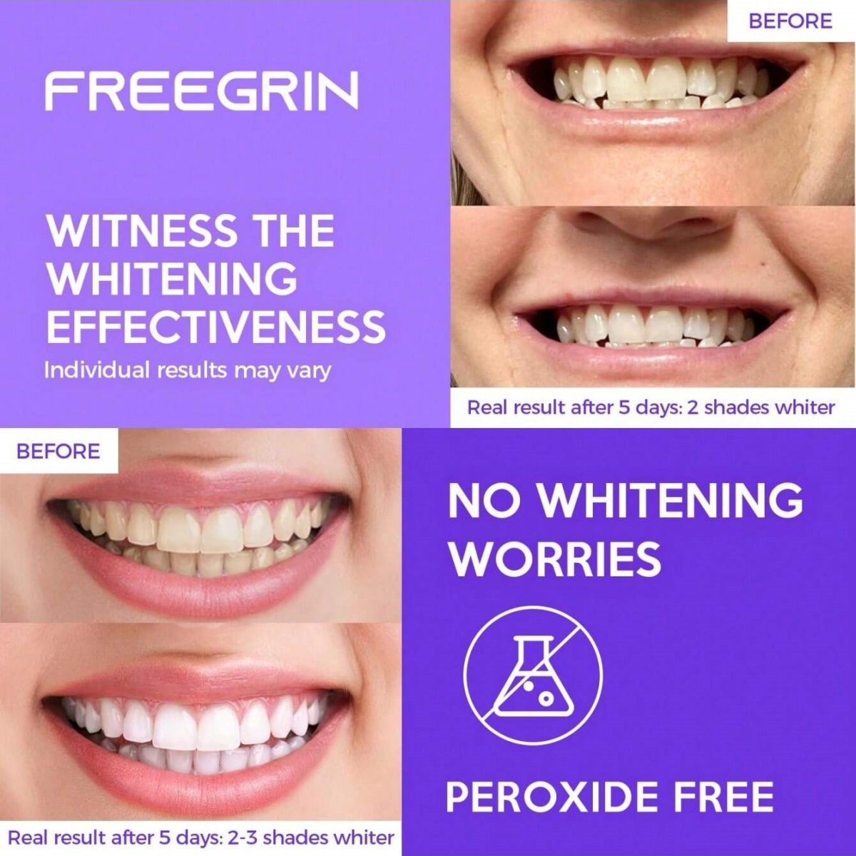デラックスホワイトニング歯ステッカー 7/14/21 ペアジ - Teeth Whitening In Office のレビューと価格