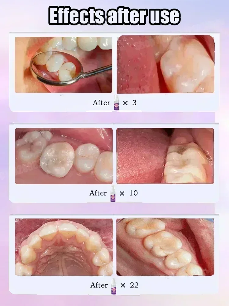 歯のクリーニング用歯磨き粉は、歯の汚れを除去し、歯を白くし、 - Teeth Whitening Cream のレビューと価格