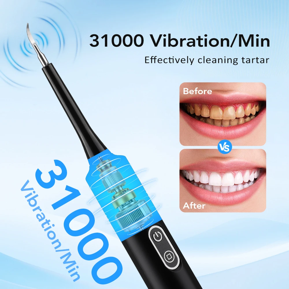 電気音波振動歯科用スケーラー歯のホワイトニング歯垢除去コーヒ - Teeth Whitening Products のレビューと価格
