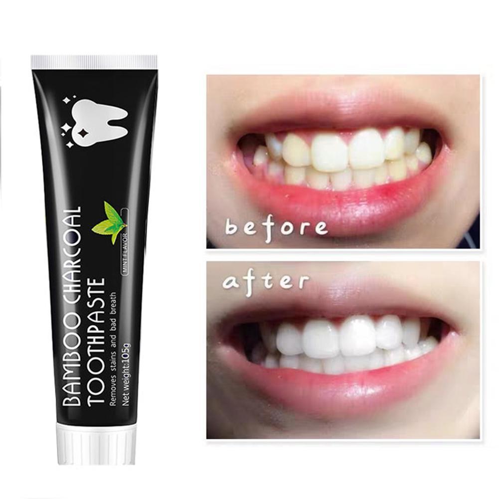 竹炭歯磨き粉 ホワイトニング歯活性炭 黄ばみ除去 歯の汚れを - Teeth Whitening Activated Organic Charcoal のレビューと価格